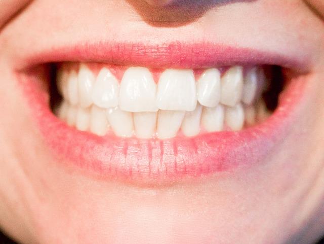 Healthy teeth